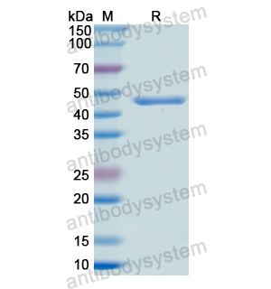 Recombinant Human SRD5A2, N-GST