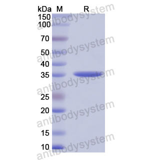 Recombinant Human SLC6A4, N-GST