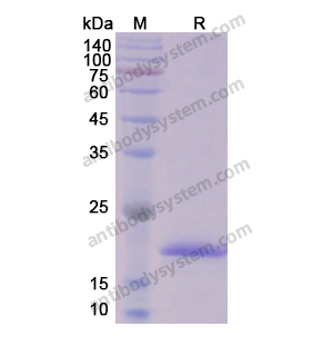 Recombinant Human AKT2, N-His