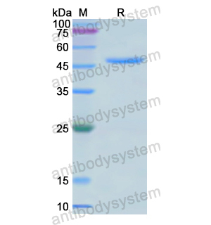 Recombinant Human ARRB2, C-His