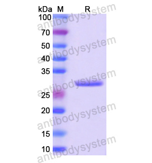 Recombinant Human GTF2H1, N-His