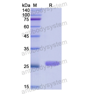 Recombinant Human CTH, N-His