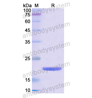 Recombinant Human CD153/TNFSF8, N-His