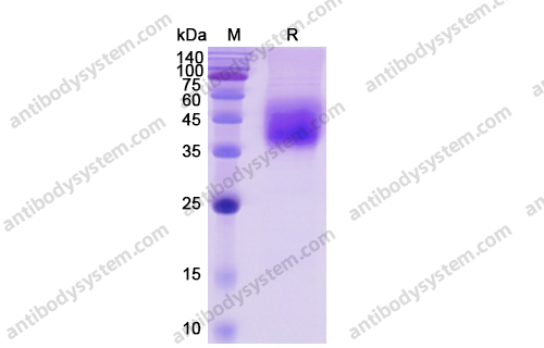 Recombinant Human CD80/B7-1, C-His