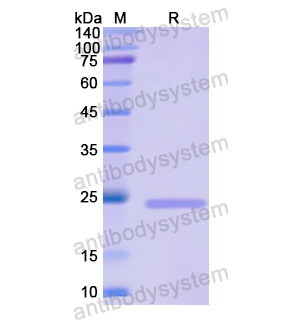 Recombinant Human MCM5, N-His（YHE04301）