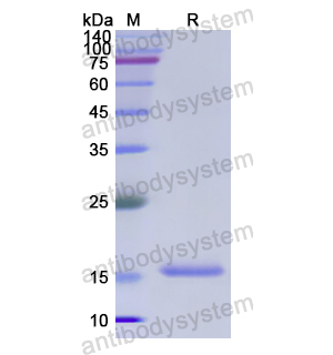 Recombinant Human PFN2, N-His