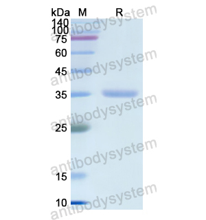 Recombinant Human CA8, N-His