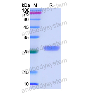 Recombinant Human CTNNA1, N-His