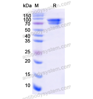 Recombinant Human CTNNB1, N-His