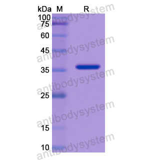 Recombinant Human SFTPD, N-His