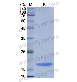 Recombinant Human ADRA1A, N-His