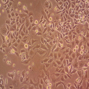 SNU-81人结肠腺癌细胞