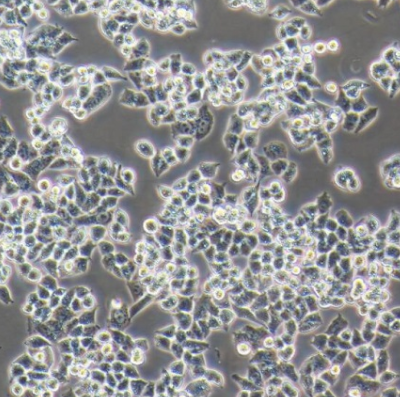 OVCA433 人卵巢癌细胞