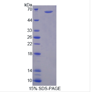 肽基精氨酸脱亚氨酶Ⅱ(PADI2)重组蛋白