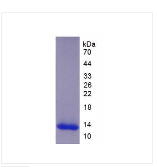 血小板反应蛋白解整合素金尾肽酶8(ADAMTS8)重组蛋白