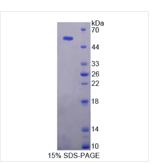 泛素特异性肽酶7(USP7)重组蛋白 