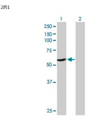 Anti-CYP2A6 antibody produced in rabbit