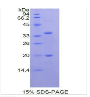 丝氨酸肽酶抑制因子KAZAL型5(SPINK5)重组蛋白