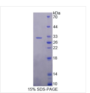 泛素特异性肽酶1(USP1)重组蛋白 