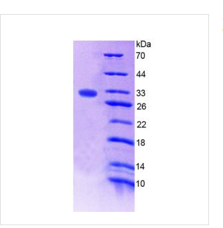   凝血因子XⅢA1肽(F13A1)重组蛋白  