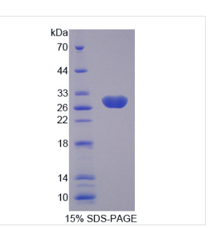 激肽释放酶4(KLK4)重组蛋白