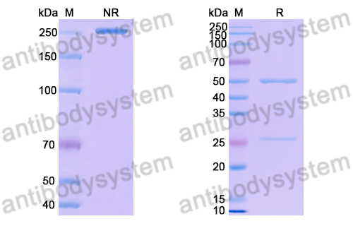 Human RAGE Antibody (XT-M4) RHH01901