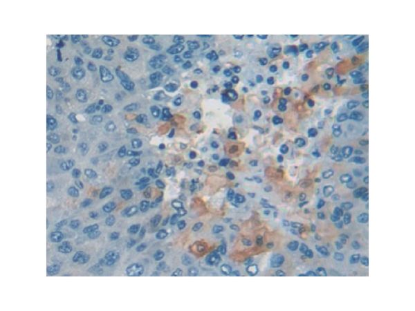 aladdin 阿拉丁 Ab005387 Carcino Embryonic Antigen CEA Antibody pAb; Rabbit anti Human Carcino Embryonic Antigen CEA Antibody; WB, IHC; Unconjugated