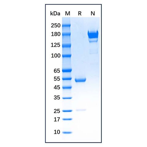 aladdin 阿拉丁 Ab005457 Myeloperoxidase Mouse mAb mAb(2C1-8); Mouse anti Human Myeloperoxidase Antibody; Detection Antibody, ELISA, CLIA, LF, GICA, FIA, LETIA; Unconjugated