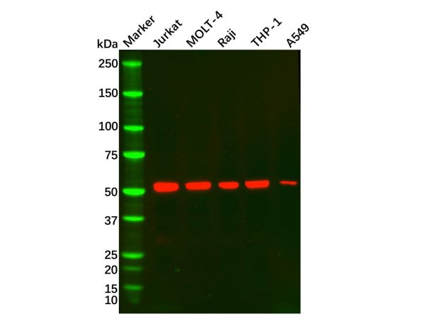 aladdin 阿拉丁 Ab006674 CD5 Mouse mAb mAb (D13); Mouse anti Human CD5 Antibody; WB; Unconjugated