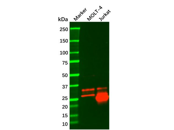 aladdin 阿拉丁 Ab006798 CD99 Mouse mAb mAb(1B10E12); Mouse anti Human CD99 Antibody; WB, IHC, FCM, ELISA; Unconjugated