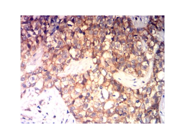 aladdin 阿拉丁 Ab006798 CD99 Mouse mAb mAb(1B10E12); Mouse anti Human CD99 Antibody; WB, IHC, FCM, ELISA; Unconjugated