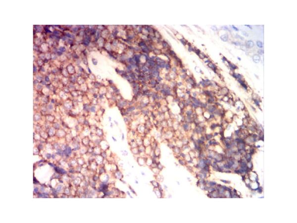 aladdin 阿拉丁 Ab006798 CD99 Mouse mAb mAb(1B10E12); Mouse anti Human CD99 Antibody; WB, IHC, FCM, ELISA; Unconjugated