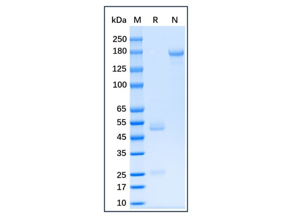 aladdin 阿拉丁 Ab007362 Follicle Stimulating Hormone beta (FSHB) Mouse mAb mAb(29B5); Mouse anti Human Follicle Stimulating Hormone beta (FSHB)  Antibody; Detection Antibody, ELISA, CLIA, LF, GICA, FIA; Unconjugated