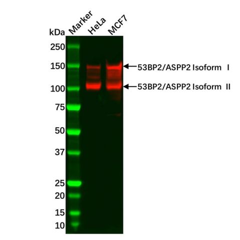 aladdin 阿拉丁 Ab086727 Recombinant 53BP2/ASPP2 Antibody Recombinant (R09-1B5); Rabbit anti Human 53BP2/ASPP2 Antibody; WB; Unconjugated