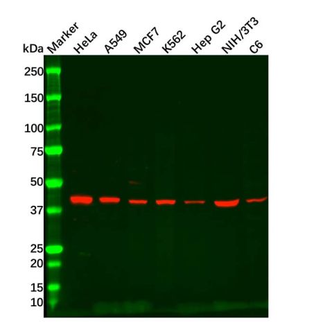 aladdin 阿拉丁 Ab087082 Recombinant ACADM/MCAD Antibody Recombinant (R04-4F0); Rabbit anti Human ACADM/MCAD Antibody; WB, IHC, ICC, IF; Unconjugated