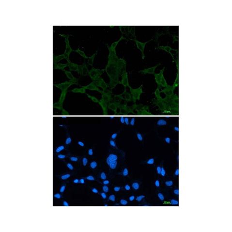 aladdin 阿拉丁 Ab087082 Recombinant ACADM/MCAD Antibody Recombinant (R04-4F0); Rabbit anti Human ACADM/MCAD Antibody; WB, IHC, ICC, IF; Unconjugated