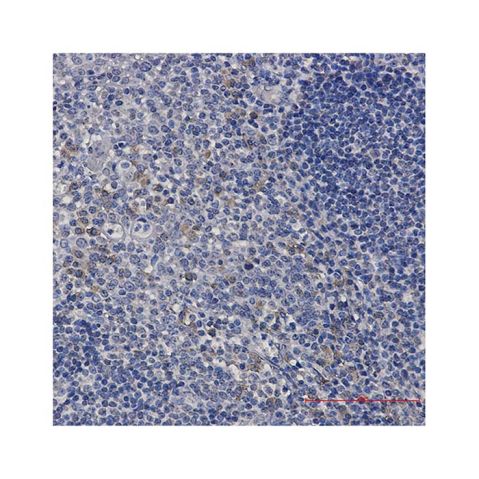 aladdin 阿拉丁 Ab087082 Recombinant ACADM/MCAD Antibody Recombinant (R04-4F0); Rabbit anti Human ACADM/MCAD Antibody; WB, IHC, ICC, IF; Unconjugated