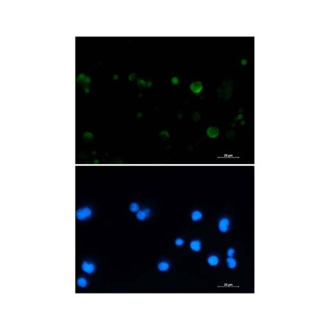 aladdin 阿拉丁 Ab087199 Recombinant Aconitase 2 Antibody Recombinant (R07-7A1); Rabbit anti Human Aconitase 2 Antibody; WB, IHC, ICC, IF; Unconjugated