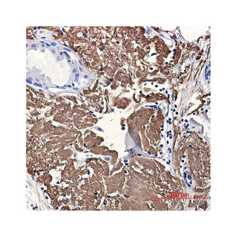 aladdin 阿拉丁 Ab087199 Recombinant Aconitase 2 Antibody Recombinant (R07-7A1); Rabbit anti Human Aconitase 2 Antibody; WB, IHC, ICC, IF; Unconjugated