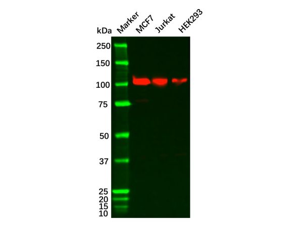 aladdin 阿拉丁 Ab087287 NOTCH1 Antibody pAb; Rabbit anti Human NOTCH1 Antibody; WB, IHC, ICC, IF; Unconjugated