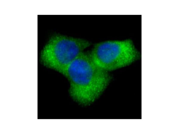 aladdin 阿拉丁 Ab087287 NOTCH1 Antibody pAb; Rabbit anti Human NOTCH1 Antibody; WB, IHC, ICC, IF; Unconjugated