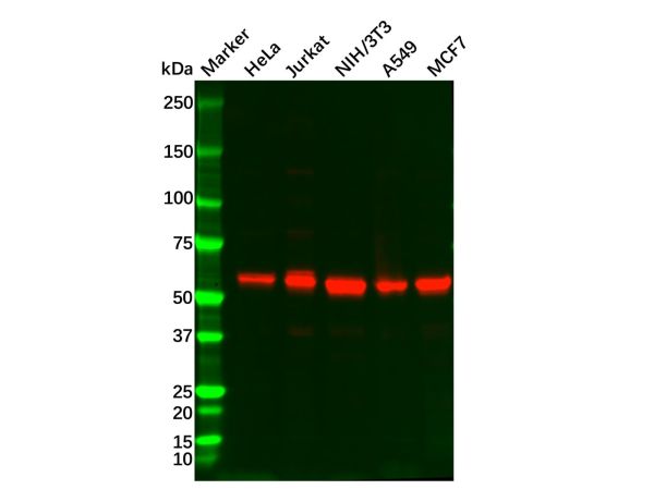 aladdin 阿拉丁 Ab087925 Recombinant AKT1/AKT2/AKT3 Antibody Recombinant (R04-8A4); Rabbit anti Human AKT1/AKT2/AKT3 Antibody; WB, IHC; Unconjugated