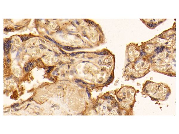 aladdin 阿拉丁 Ab088306 ATP1A1 Mouse mAb mAb (C209); Mouse anti Human ATP1A1 Antibody; WB, IHC; Unconjugated