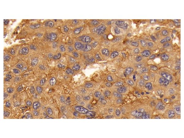 aladdin 阿拉丁 Ab088306 ATP1A1 Mouse mAb mAb (C209); Mouse anti Human ATP1A1 Antibody; WB, IHC; Unconjugated