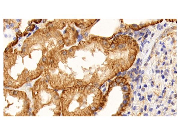 aladdin 阿拉丁 Ab088306 ATP1A1 Mouse mAb mAb (C209); Mouse anti Human ATP1A1 Antibody; WB, IHC; Unconjugated