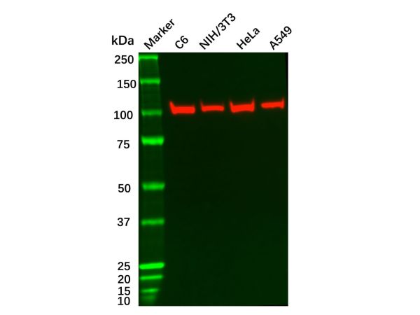 aladdin 阿拉丁 Ab088349 Recombinant ACTN4 Antibody Recombinant (R06-3D7); Rabbit anti Human ACTN4 Antibody; WB, ICC, IF; Unconjugated