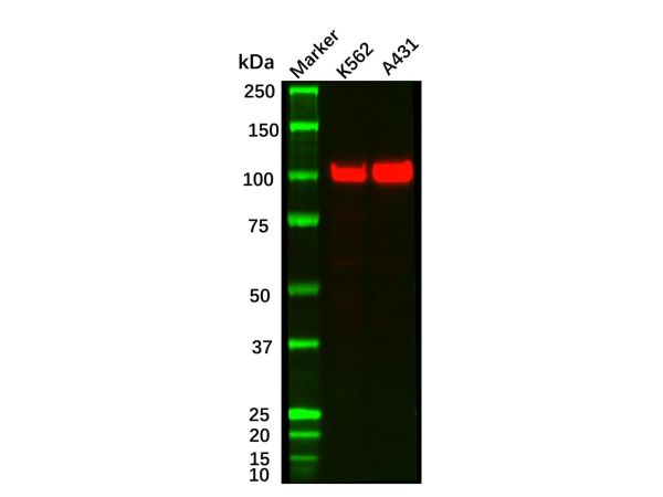 aladdin 阿拉丁 Ab088349 Recombinant ACTN4 Antibody Recombinant (R06-3D7); Rabbit anti Human ACTN4 Antibody; WB, ICC, IF; Unconjugated