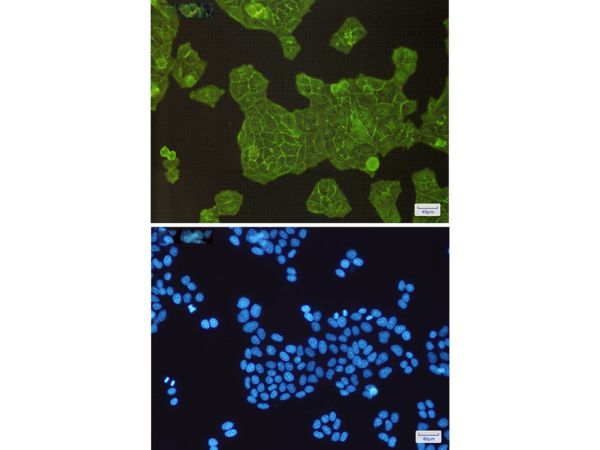 aladdin 阿拉丁 Ab088349 Recombinant ACTN4 Antibody Recombinant (R06-3D7); Rabbit anti Human ACTN4 Antibody; WB, ICC, IF; Unconjugated