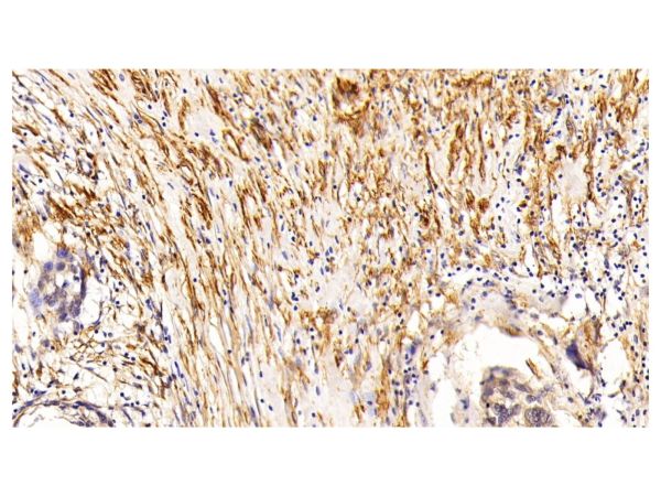 aladdin 阿拉丁 Ab088443 alpha-Smooth Muscle Actin Mouse mAb mAb (F1); Mouse anti Human alpha-Smooth Muscle Actin Antibody; WB, IHC; Unconjugated