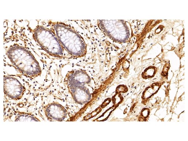 aladdin 阿拉丁 Ab088443 alpha-Smooth Muscle Actin Mouse mAb mAb (F1); Mouse anti Human alpha-Smooth Muscle Actin Antibody; WB, IHC; Unconjugated